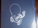 Sigur Ros 