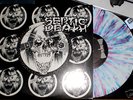 Septic Death 10