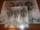 SUPERGRASS s/t LP vinyl w/POSTER
