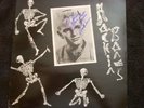 Ronnie Dawson-Rockin Bones rockabilly No Hit Meteors