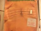 Funkoars Greatest Hits 2LP - Oz Hip Hop Vinyl Hilltop Hoods Aussie Vinyl