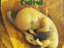 Battiato ?– Fetus