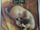 FRANCO BATTIATO - FETUS (First pressing on BLA BLA Records) NM-