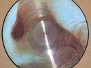 PINK FLOYD  -  PICTURE DISC  -  Meddle