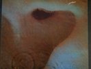 Pink floyd meddle 1971 gatefold on emi england