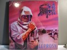 Death leprosy