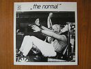 The Normal 