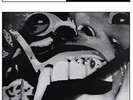 Severed Heads - Since The Accident [Vinyl New]