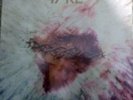 LITFIBA 17 RE -  LP