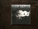Raw Nerve Every Problem Solved Test Press Youth Attack Hoax  #/25 RARE