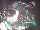 ISSUES Black Diamonds EP VINYL - 12