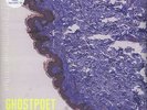 Ghostpoet - Shedding Skin Vinyl EU LP+CD