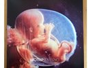 MoTrip - Embryo (Doppelvinyl) / Topzustand