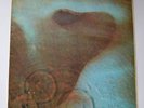 PINK FLOYD MEDDLE VINYL LP SHVL795 UK A1U/B1U 1st PRESS EX/VGC TEXTURE SLEEVE