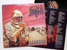 DEATH - Leprosy LP 1988 first press FLAG 24 sadus gorguts
