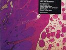 PINK FLOYD - 1965, THEIR FIRST RECORDINGS - TWO SINGLE SET - RARE, MINT + SEALED