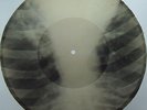 Instumental Jazz Fox Bones'n'ribs X-RAY roentgen film roentgenizdat Soviet 1950s