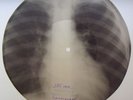 Piotr LESHCHENKO Mother heart Tango X-RAY roentgen film bones record USSR 1950s
