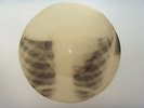Doris DAY -Everybody Loves A Lover X-ray roentgen film bones record 1950s