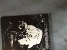 Carcass-Symphonies of Sickness Vinyl LP.(1989 MOSH18) Ex.