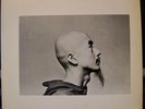 Toshi Tsuchitori – 