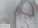 33T.   THE CURE     