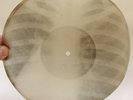 X-Ray 78rpm RUSSIAN ORCHESTRA Dark Eyes Waltz USSR AUDIO ROENTGEN Ribs Thorax