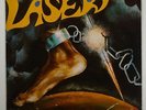 Laser 