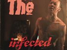 The The, Infected EPC 26770 Vinyl Album Ex Con Rare