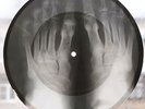 X-Ray Audio roentgen film Record Bones Ribs L Utyosov 
