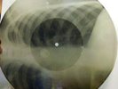 OLD USSR X-RAY RECORD ONE SIDE 78 RPM-Russian song with accordeon from 1955