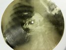 X-Ray 78rpm LESHCHENKO Wine of love Tango USSR AUDIO ROENTGEN Ribs Thorax Bones