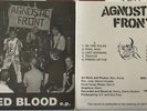 Agnostic Front United Blood EP 35th Anniversary Edition gorilla biscuits judge