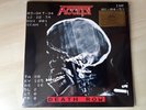 ACCEPT  -  DEATH ROW  2 LP RED VINYL 1000 LTD 180 GR. MUSIC ON VINYL REMASTERT