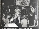 Agnostic Front United Blood Ep 35th Anniversary Edition Limited Pressing