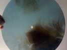 ELVIS PRESLEY - SURRENDER - UNIQUE USSR GEORGIAN X-RAY ROENTGEN BONES RECORD