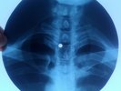 YARDBIRDS - FOR YOUR LOVE - UNIQUE USSR GEORGIAN X-RAY ROENTGEN BONES SKULL RIBS