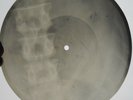 UNKNOWN IRANIAN FEMALE FOLK SINGER - GEORGIAN USSR X-RAY ROENTGEN SPINE BONES