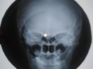 Elvis Presley Jailhouse Rock X-RAY USSR ROENTGEN Bones Record