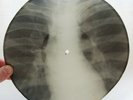 X-Ray 78rpm LESHCHENKO sings 