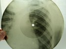 X-Ray 78rpm 