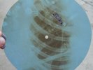 STILLERS - I'M SORRY - UNIQUE USSR GEORGIAN X-RAY ROENTGEN RIBS RECORD