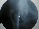 Louis Armstrong - Mack The Knife  X-RAY UNIQUE USSR ROENTGEN Bones Record