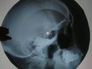 Bob Dylan - Subterranean Homesick Blues X-RAY USSR ROENTGEN Bones Record