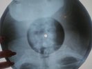 Kinks - Waterloo Sunset X-RAY USSR ROENTGEN Bones Record