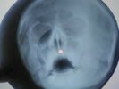 Rolling Stones - Brown Sugar X-RAY USSR ROENTGEN Bones Record Skull
