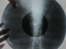 Simon and Garfunkel - Mrs. Robinson X-RAY USSR ROENTGEN Bones Record