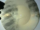 X-RAY 78rpm BLUE TAXI (blatnyak) USSR RARE AUDIO ROENTGEN Ribs