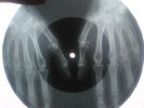 Aretha Franklin - Respect X-RAY USSR ROENTGEN Bones Record