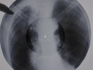 Beatles - Lucy in the Sky with Diamonds X-RAY USSR ROENTGEN Bones Record